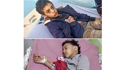 إصابة طفلين جرّاء اشتباكات بين مليشيا الحوثي ومسلحين في إب اليمنية 