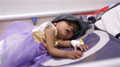 تقرير.. سوء تغذية حاد يهدد أطفال الضالع وسط انهيار الخدمات الصحية