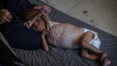 غزة.. 11 حالة وفاة جديدة نتيجة المجاعة خلال 24 ساعة