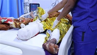 إصابة 4 مدنيين بانفجار لغمين من مخلفات الحوثيين في ذو باب غربي تعز اليمنية 